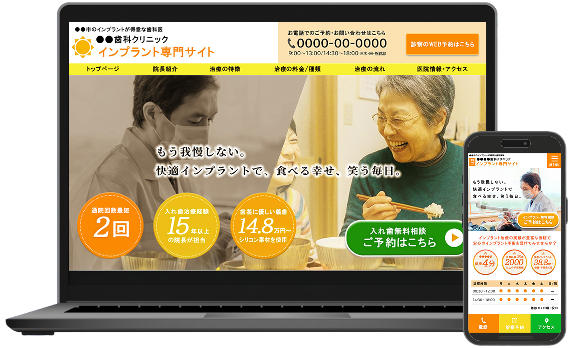 モックアップ用インプラント医院